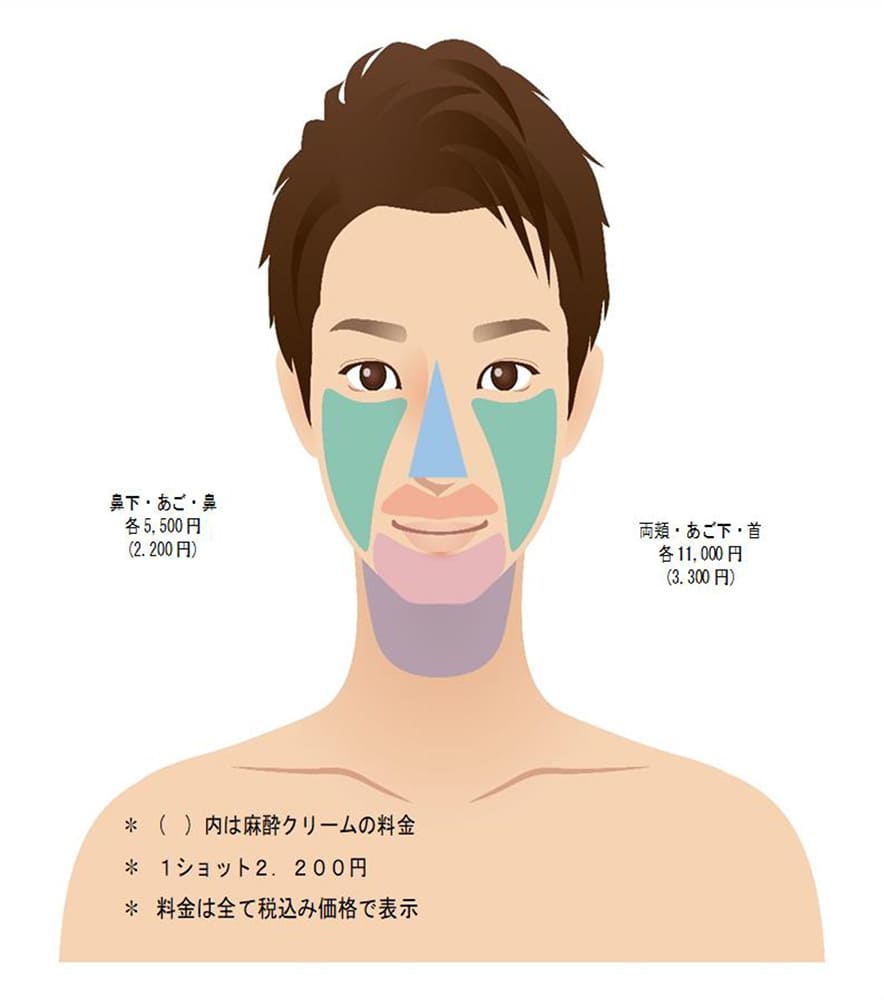 男性の脱毛部位