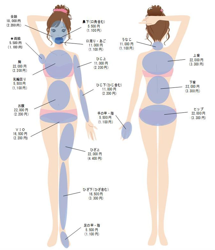 女性の脱毛部位