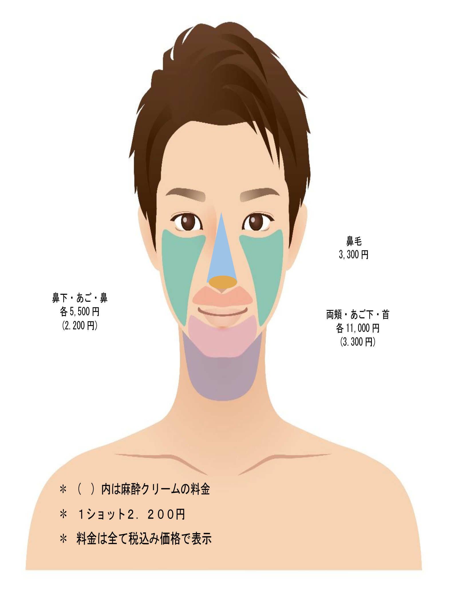 男性の脱毛部位
