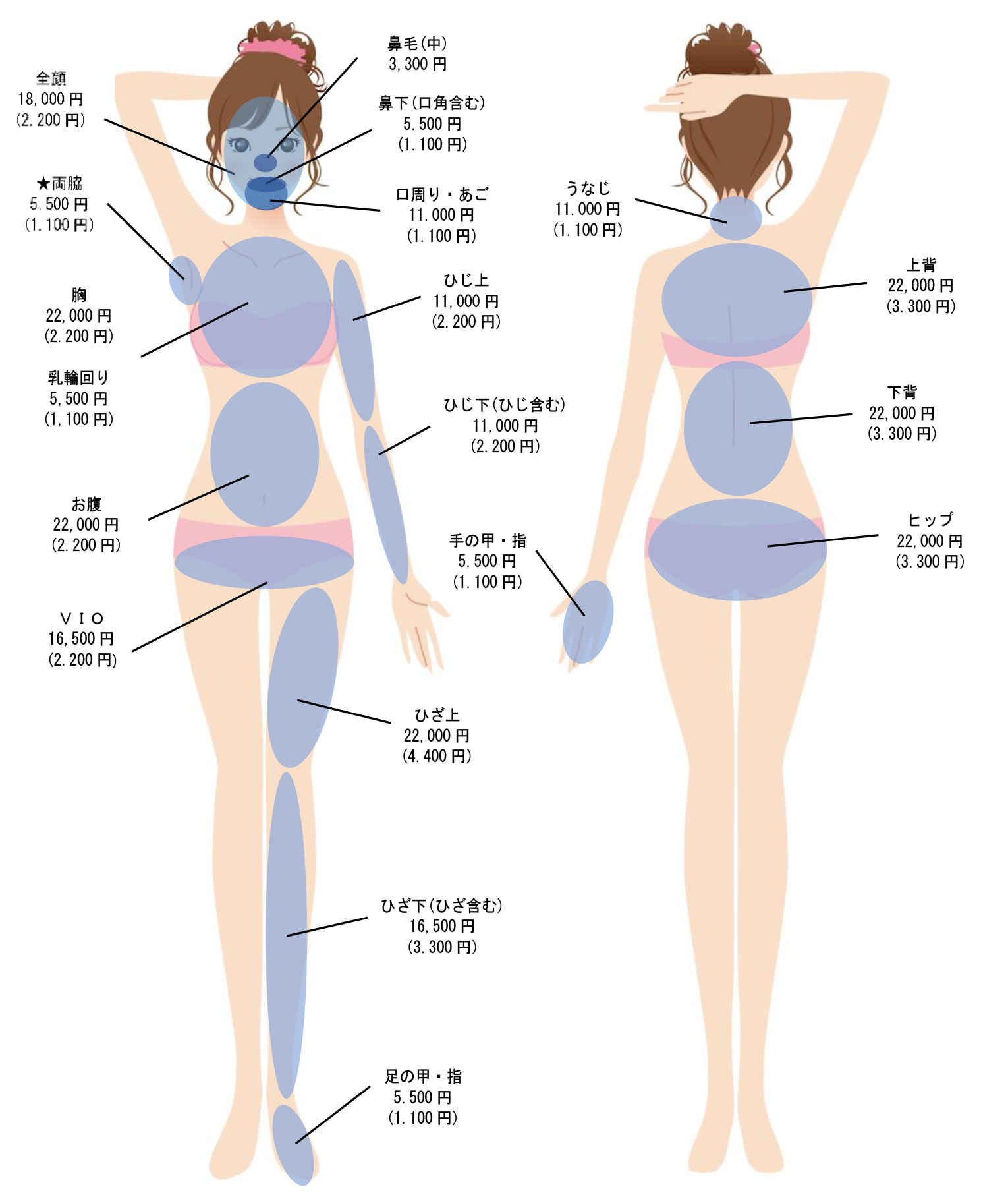 女性の脱毛部位