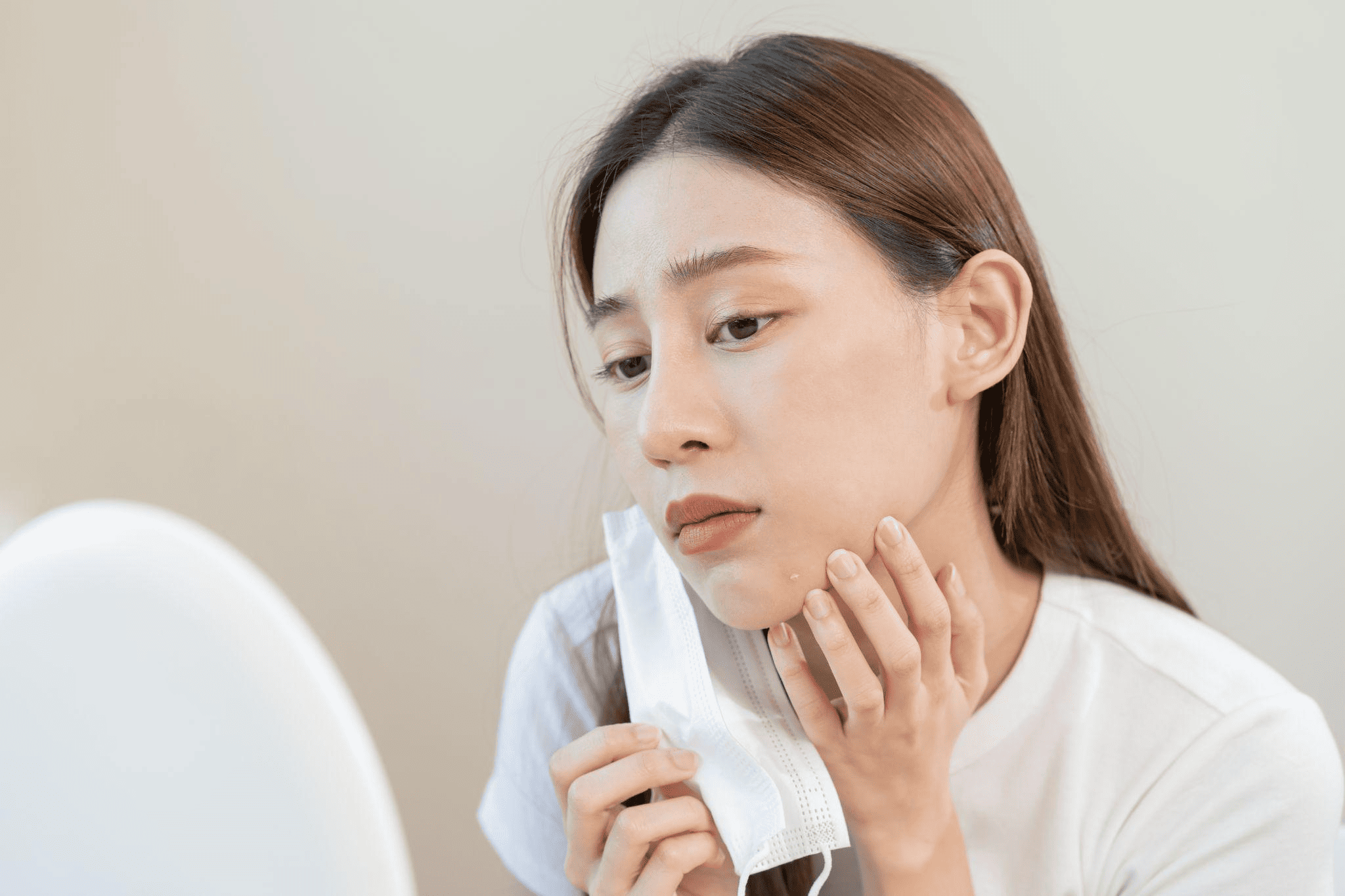 保険適用されるニキビ治療の条件